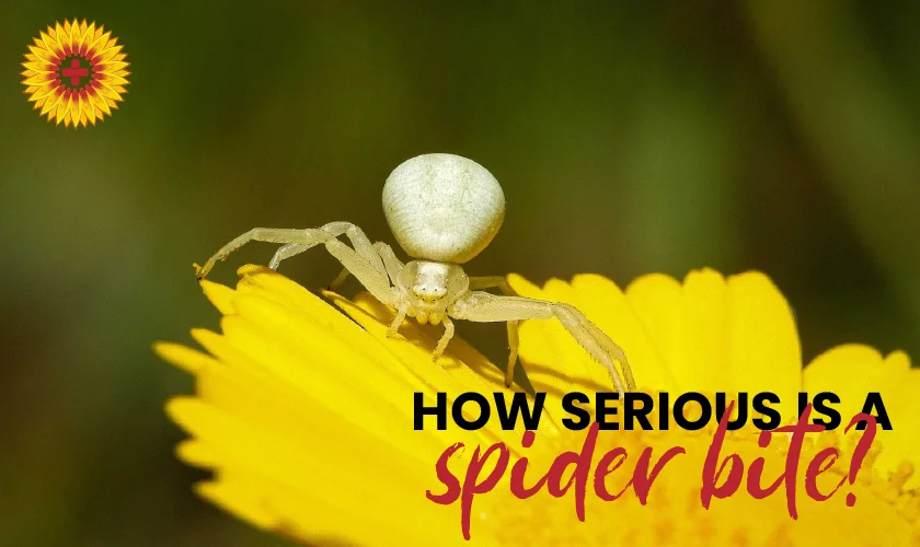 Spider Bites: Symptoms, Treatment, and Prevention