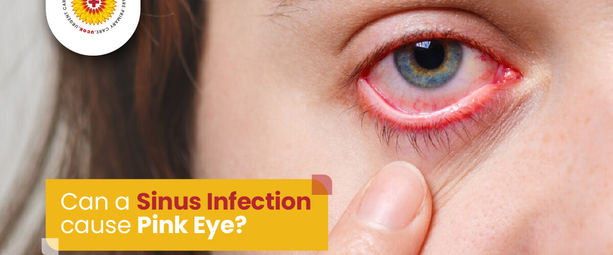 Urgent Care Can a sinus infection cause pink eye