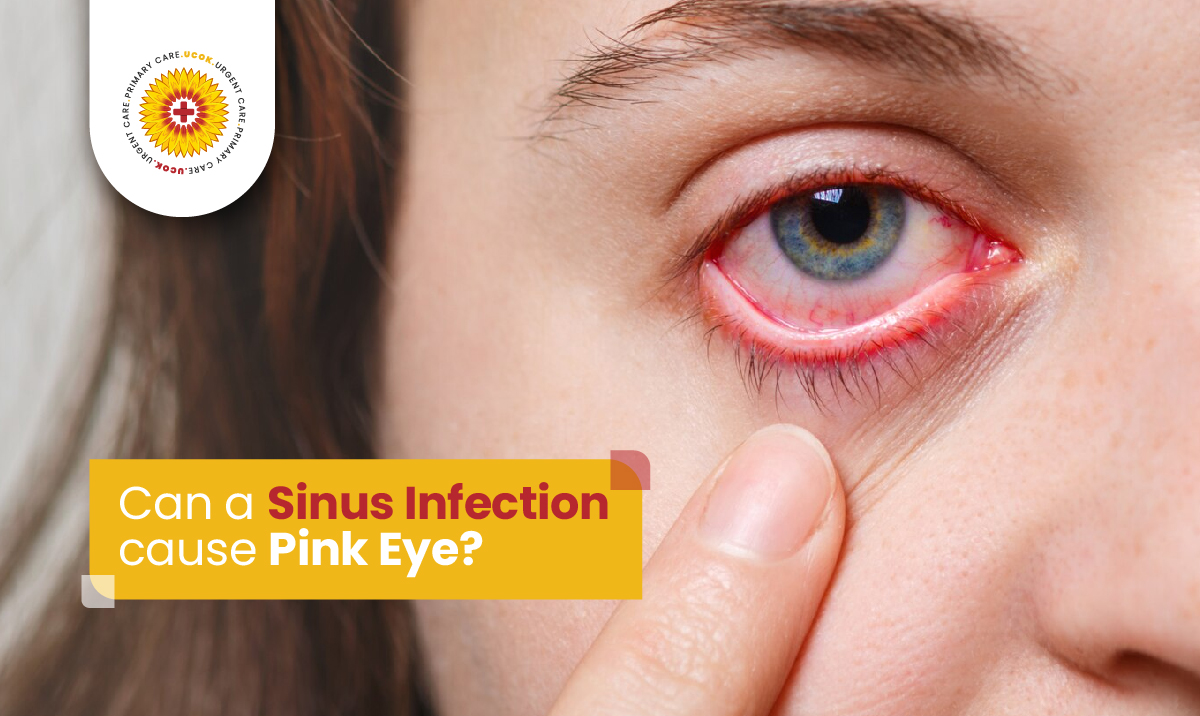 Urgent Care Can a sinus infection cause pink eye