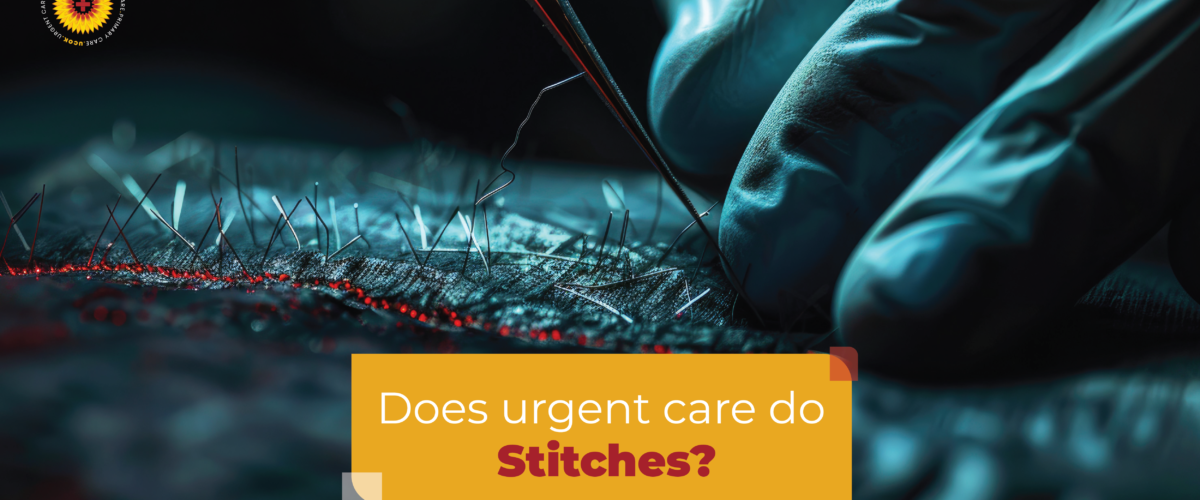 Does Urgent Care Do Stitches