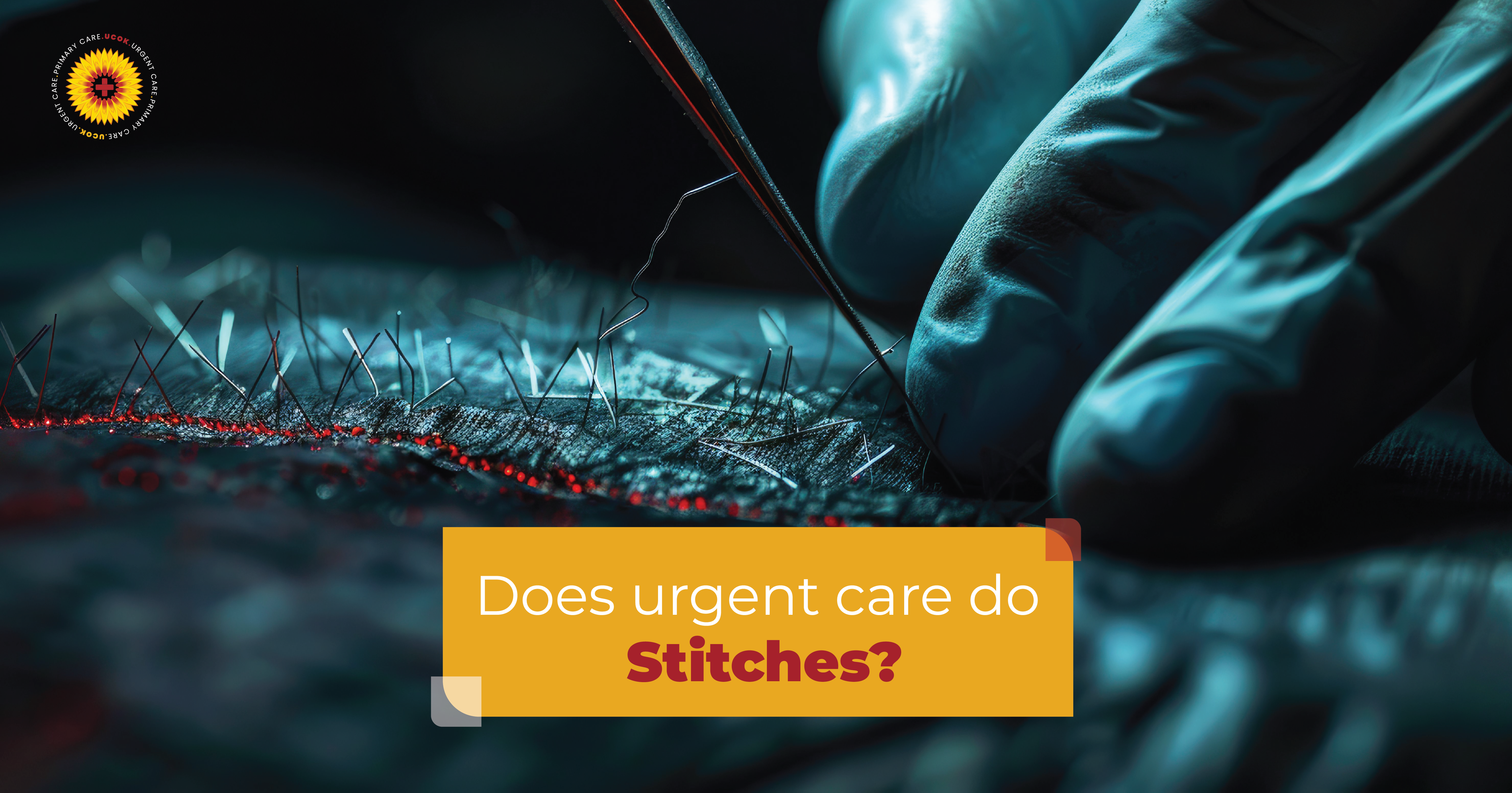 Does Urgent Care Do Stitches