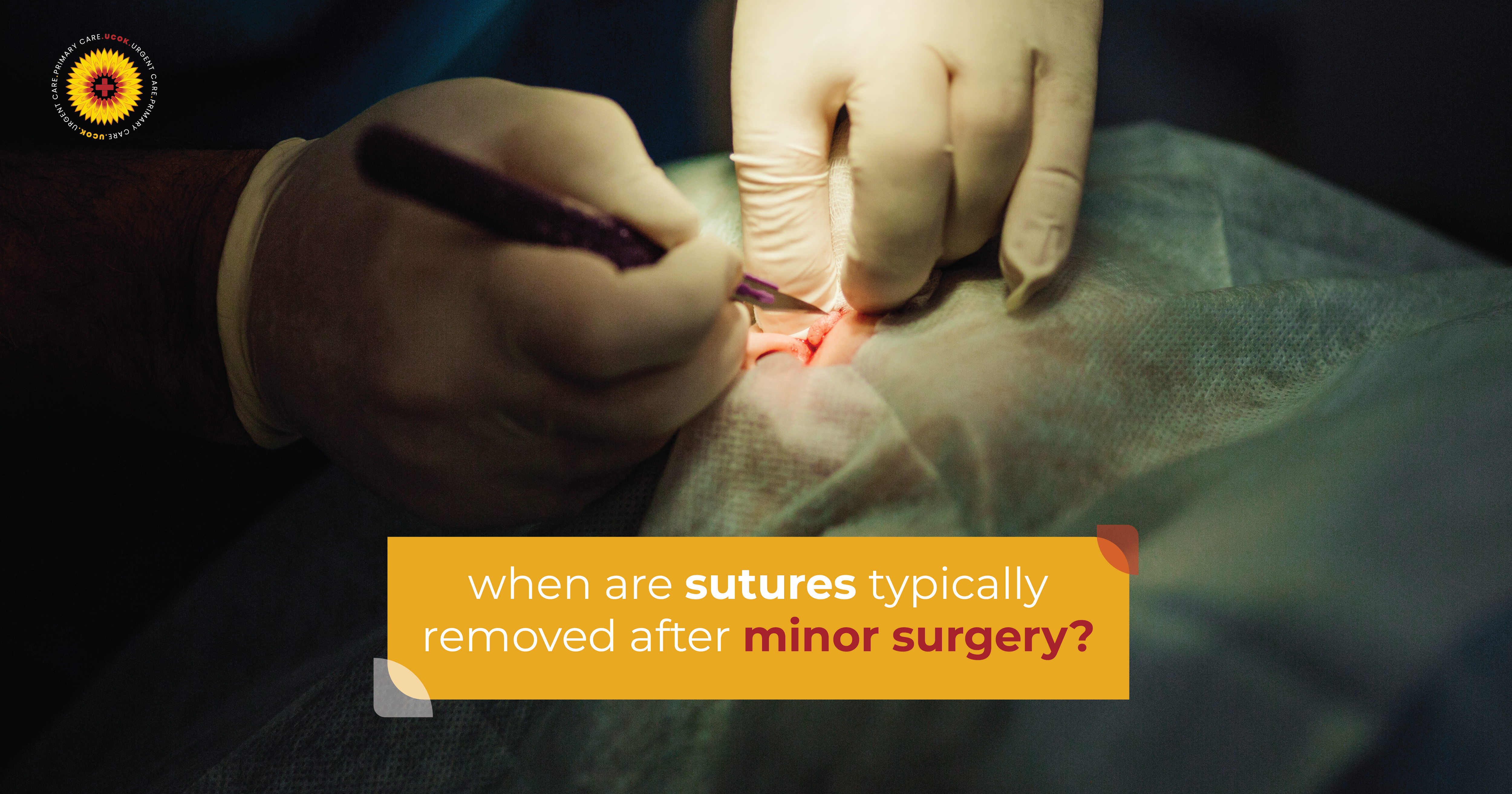 When Are Sutures Typically Removed After Minor Surgery