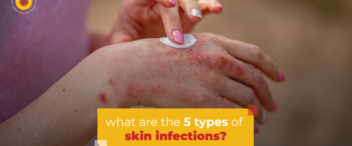 What Are the 5 Types of Skin Infections