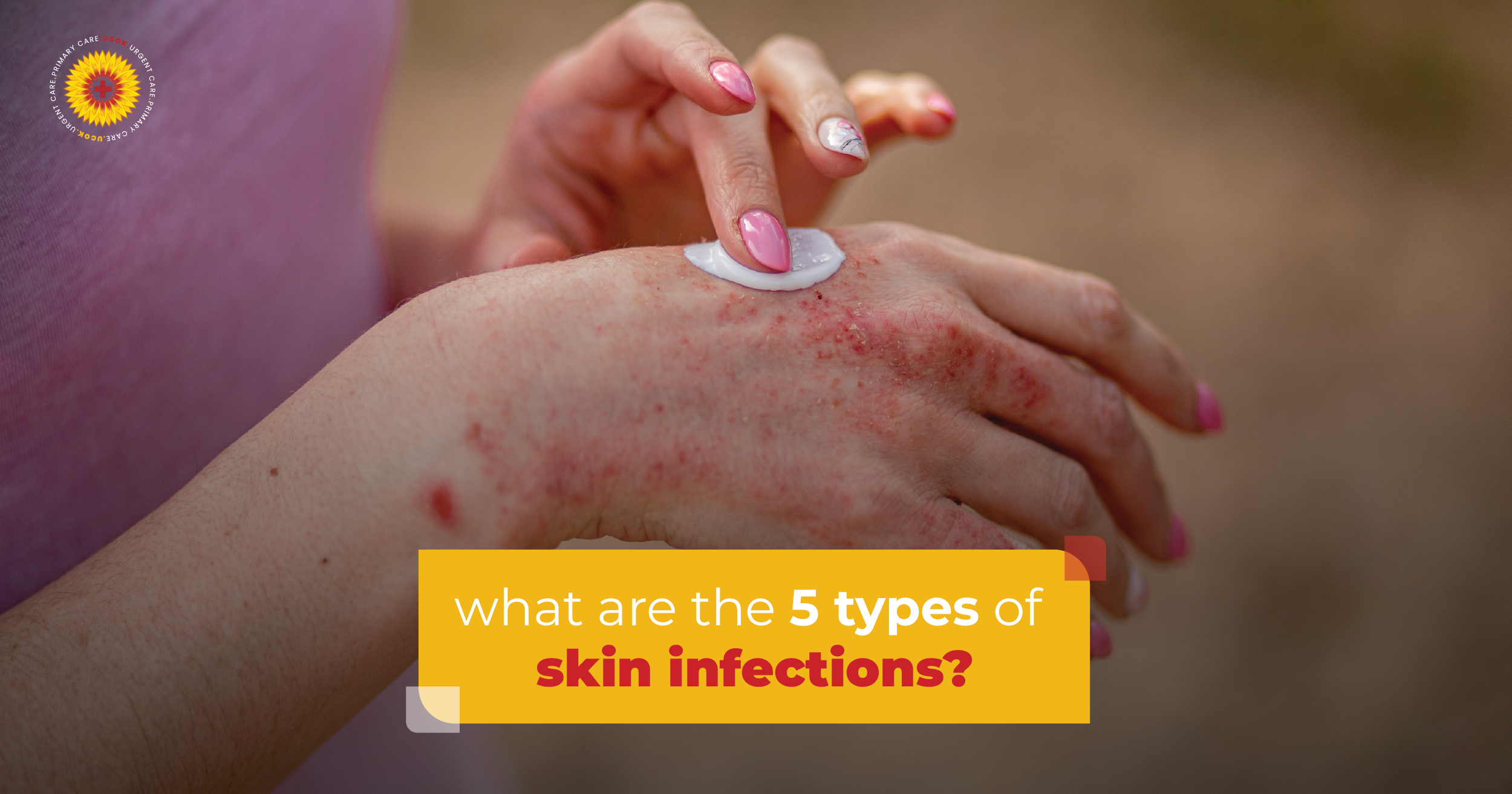 What Are the 5 Types of Skin Infections