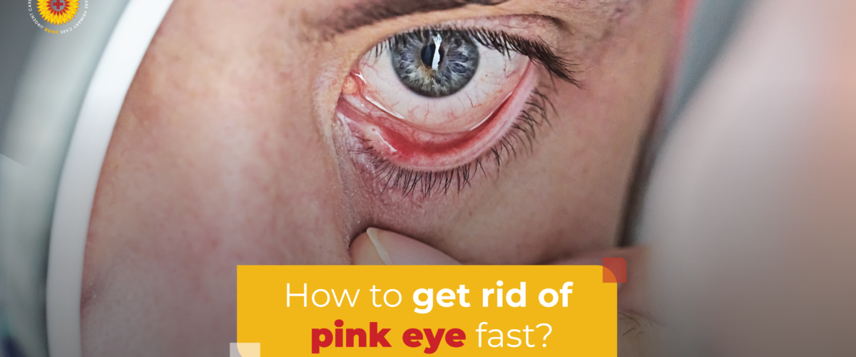 How to get rid of pink eye fast