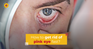 How to get rid of pink eye fast