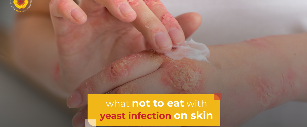 What Not to Eat with Yeast Infection on Skin