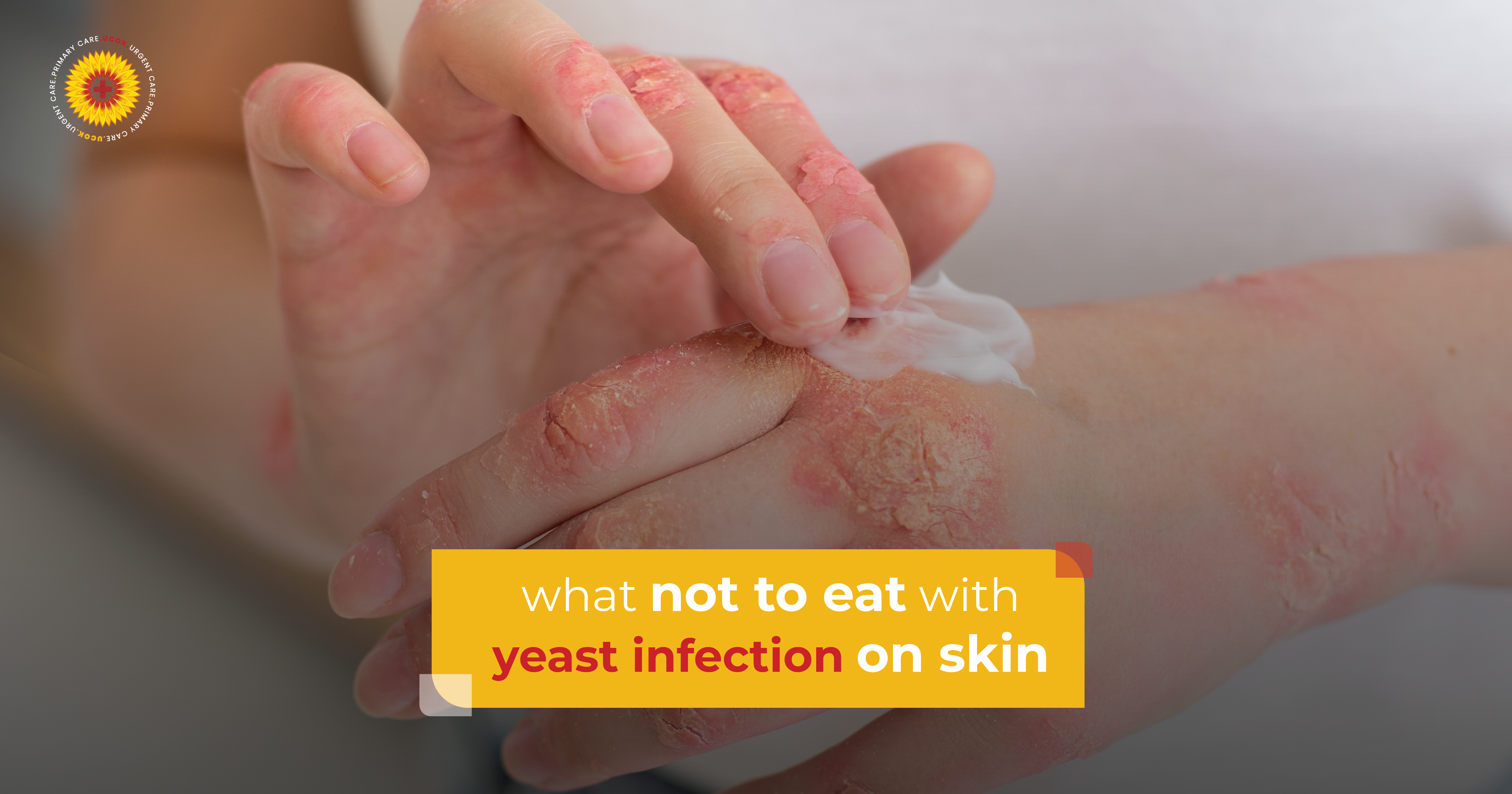 What Not to Eat with Yeast Infection on Skin