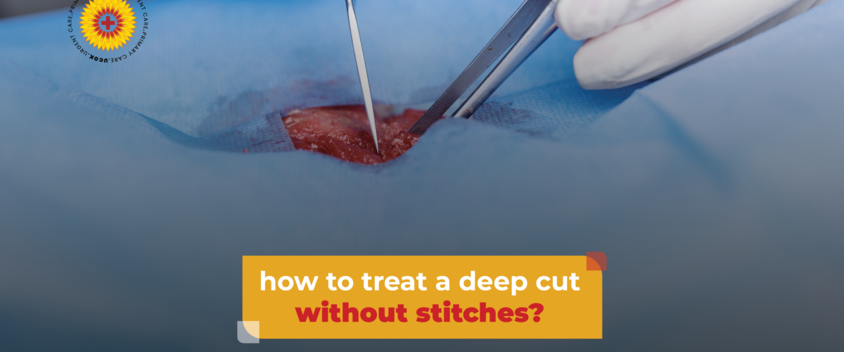 How to Treat a Deep Cut Without Stitches