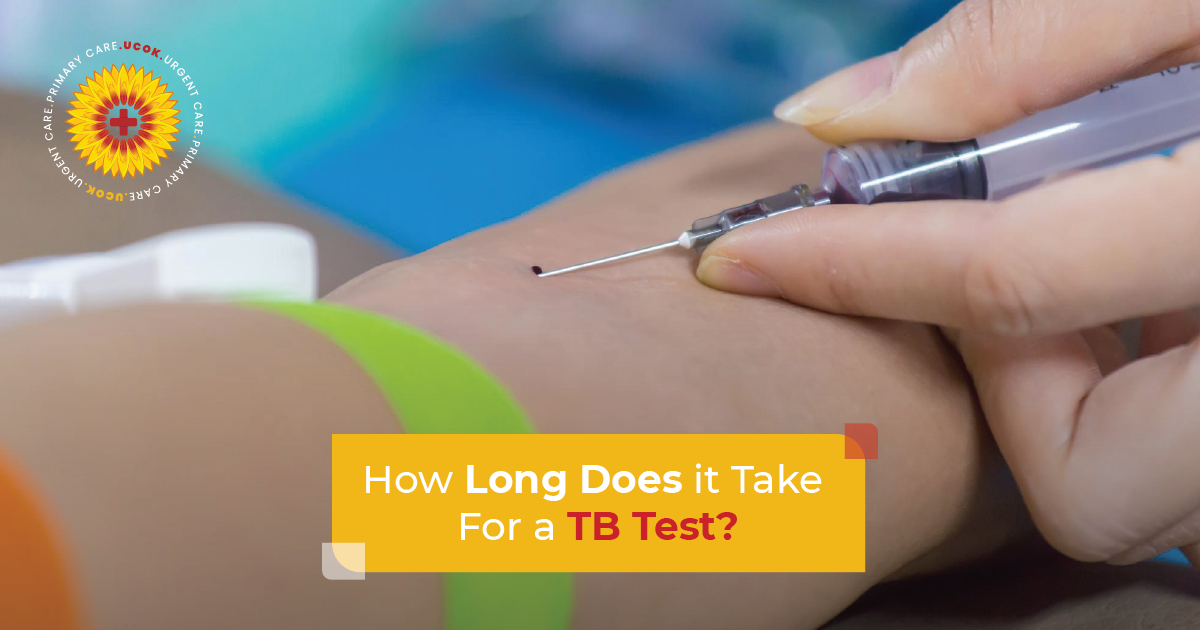 How Long Does It Take for a TB Test