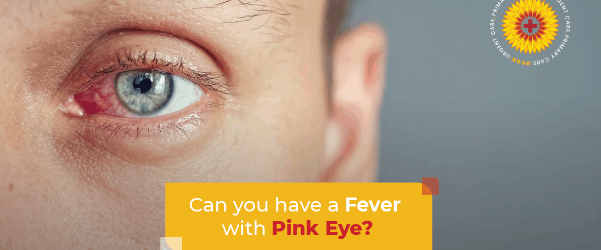 Can You Have a Fever with Pink Eye