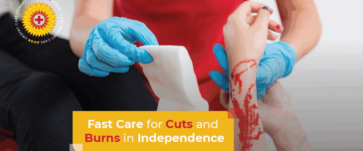 Fast Care for Cuts and Burns in Independence