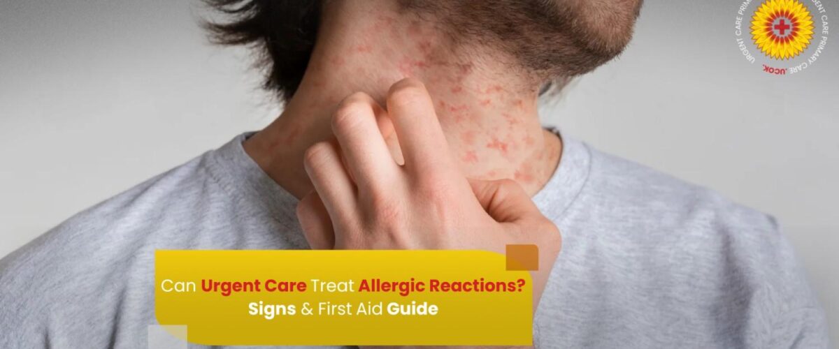 Allergic Reactions Signs & First Aid Guide