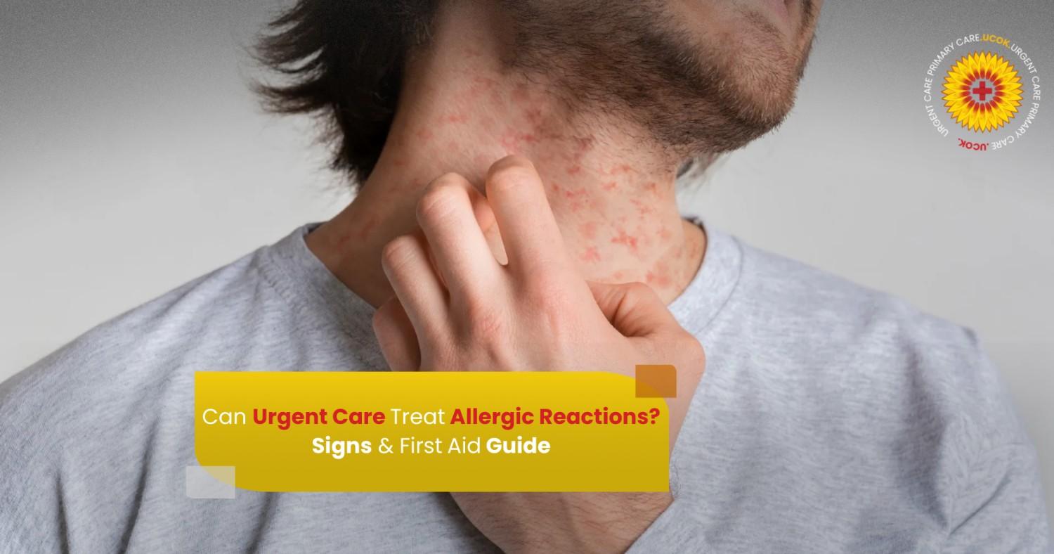 Allergic Reactions Signs & First Aid Guide