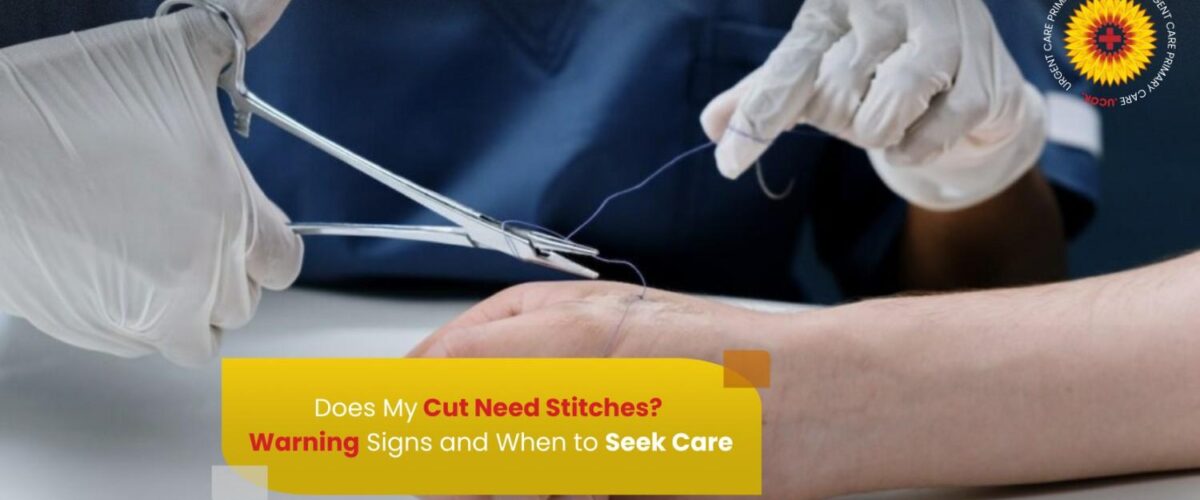 Does My Cut Need Stitches Warning Signs and When to Seek Care