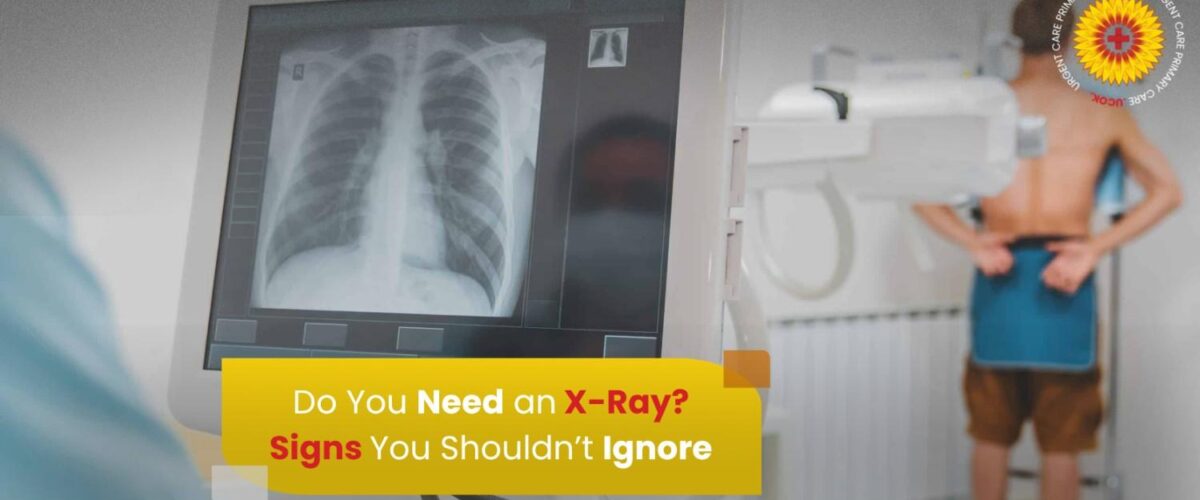 Do You Need an X Ray Signs You Shouldnt Ignore
