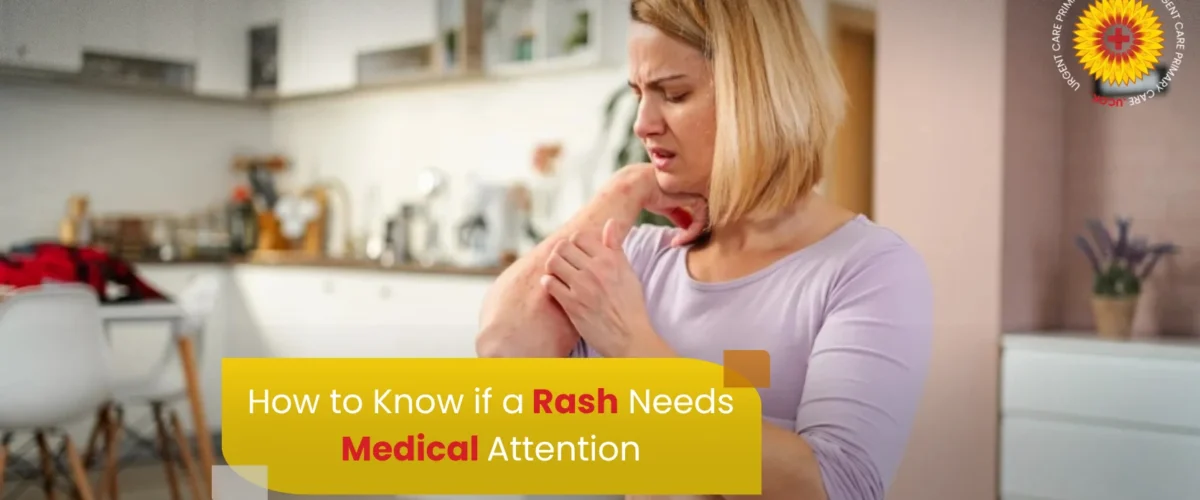 How to Know if a Rash Needs Medical Attention