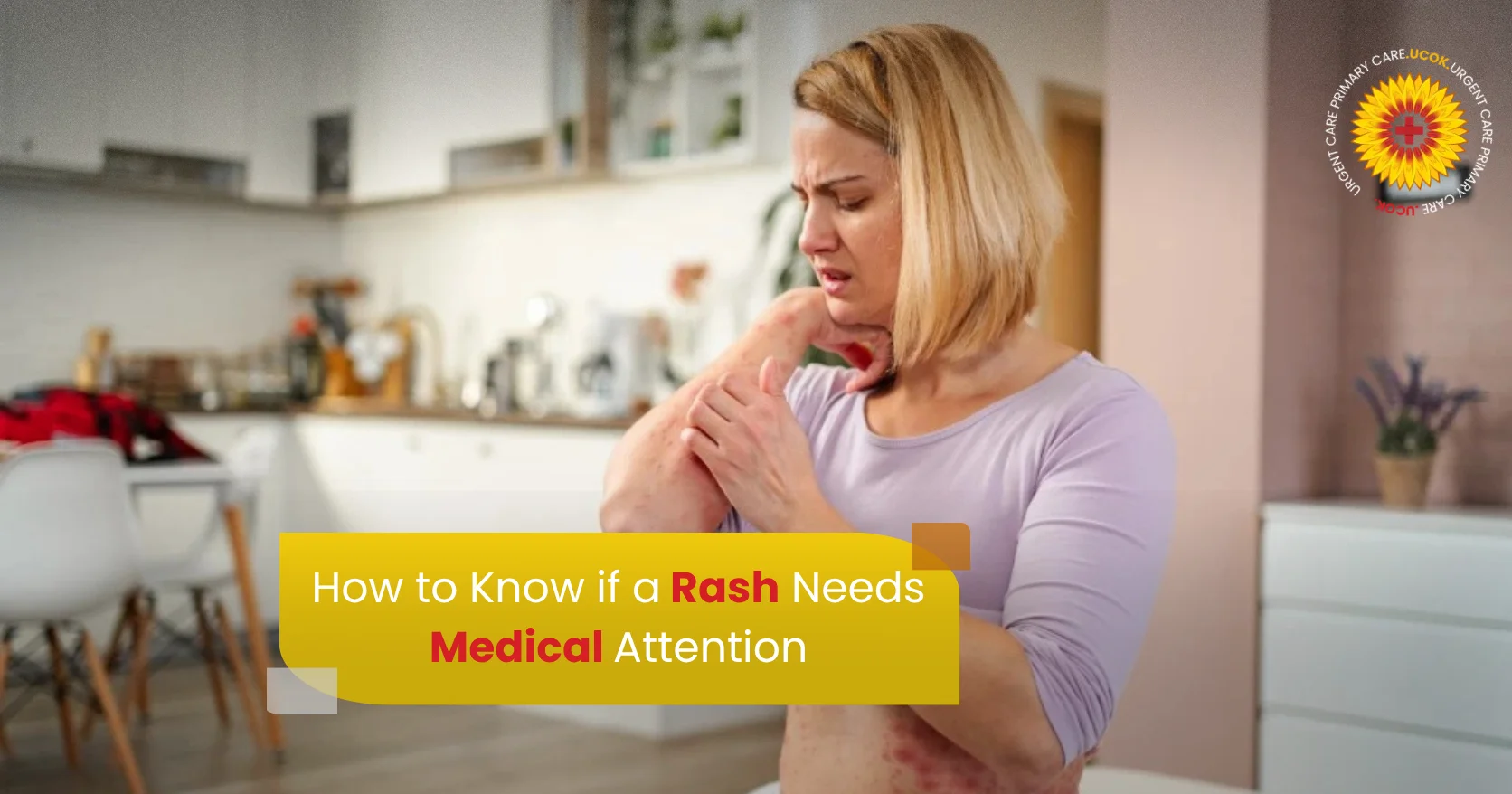 How to Know if a Rash Needs Medical Attention