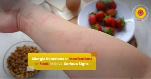 Allergic Reactions to Medications or Food Mild vs  Serious Signs